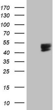 TP53BP1 Antibody