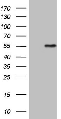 TP53BP1 Antibody