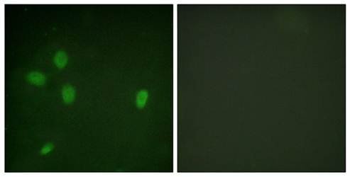 53BP1 (Phospho-Ser25) Antibody