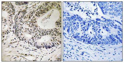 53BP1 (Phospho-Ser25) Antibody