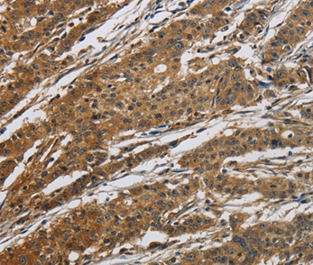 CLDN2 Antibody