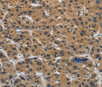 CLDN2 Antibody