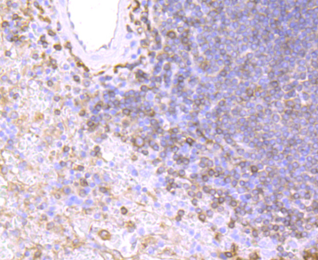 MHC Class II antibody