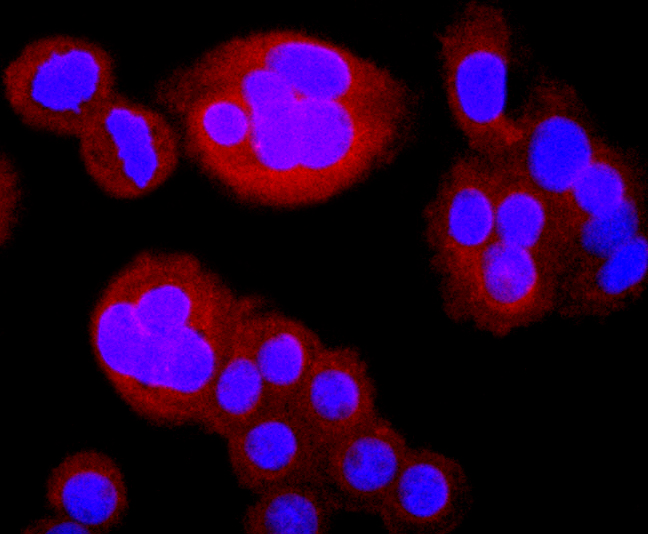 Thymidine Kinase 1 Antibody