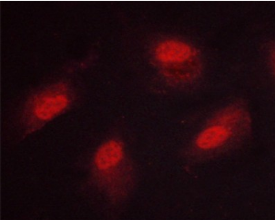 CaMk4 (Phospho-Thr196/200) antibody