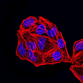 MSH2 Antibody