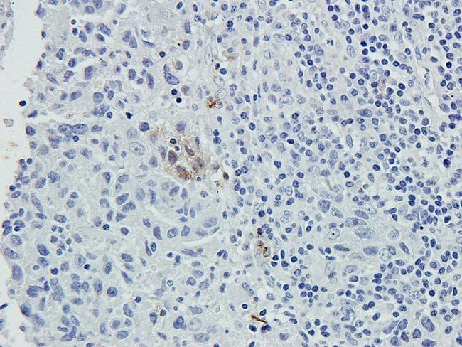 5-HT2B Receptor antibody