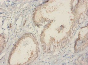 60 kDa SS-A/Ro ribonucleoprotein antibody