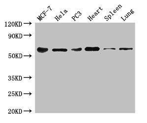 60 kDa SS-A/Ro ribonucleoprotein antibody