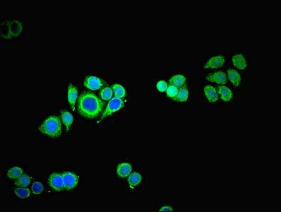 60 kDa SS-A/Ro ribonucleoprotein antibody