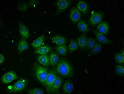 60 kDa SS-A/Ro ribonucleoprotein antibody