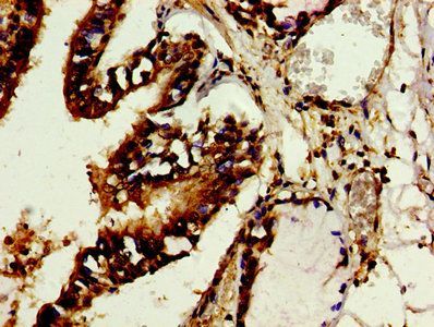 60 kDa SS-A/Ro ribonucleoprotein antibody