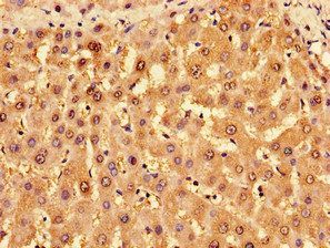 TROVE2 Antibody