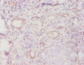 TROVE2 Antibody