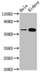 60 kDa SS-A/Ro ribonucleoprotein antibody