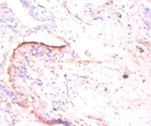 RPLP1 Antibody