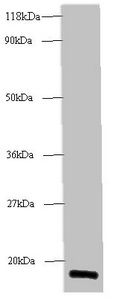 60S acidic ribosomal protein P1 antibody