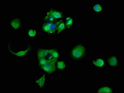 60S ribosomal protein L11 antibody