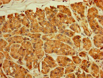 RPL11 Antibody