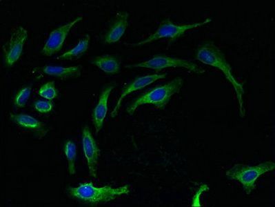 60S ribosomal protein L27 antibody