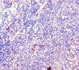 60S ribosomal protein L35a antibody