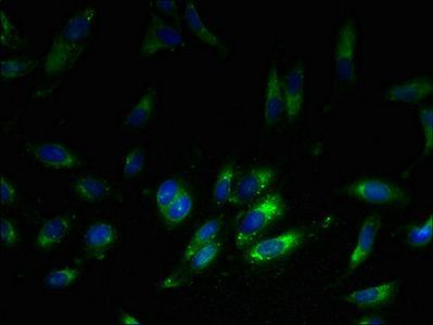 60S ribosomal protein L38 antibody