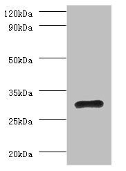 60S ribosomal protein L5 antibody