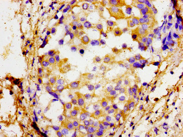 SOX11 antibody