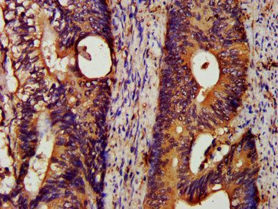 78 kDa glucose-regulated antibody