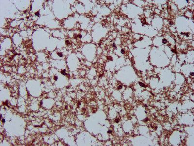 HSPA5 Antibody