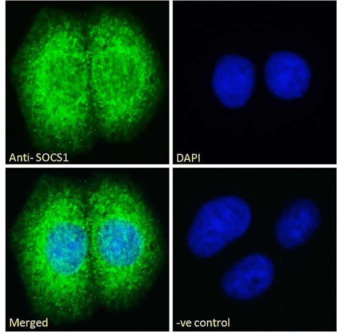 Goat anti-SOCS1 Antibody