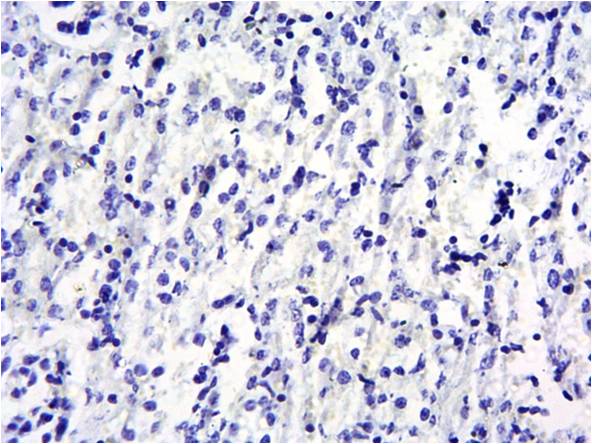 Goat anti-SOCS1 Antibody