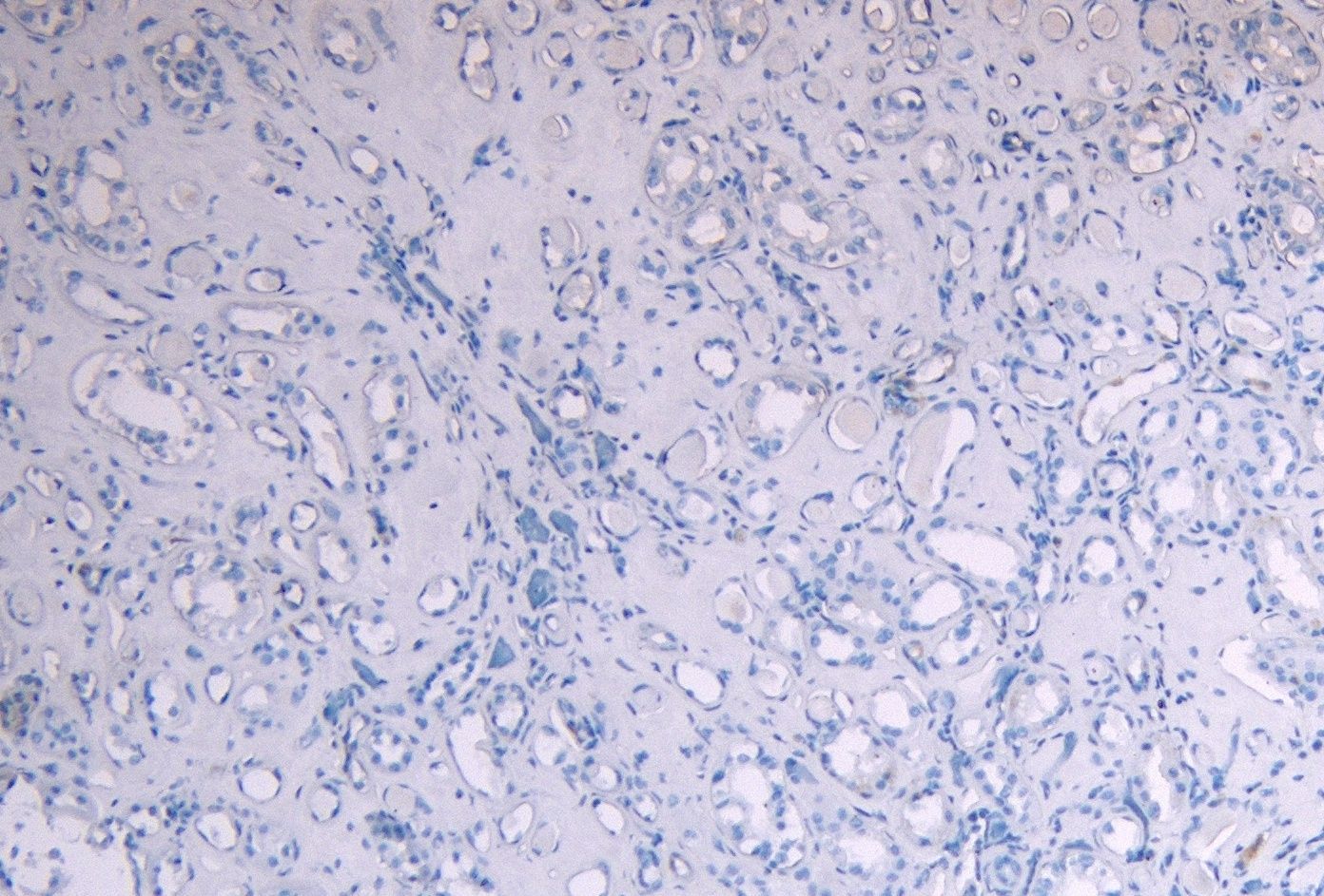 Goat anti-SOCS1 Antibody