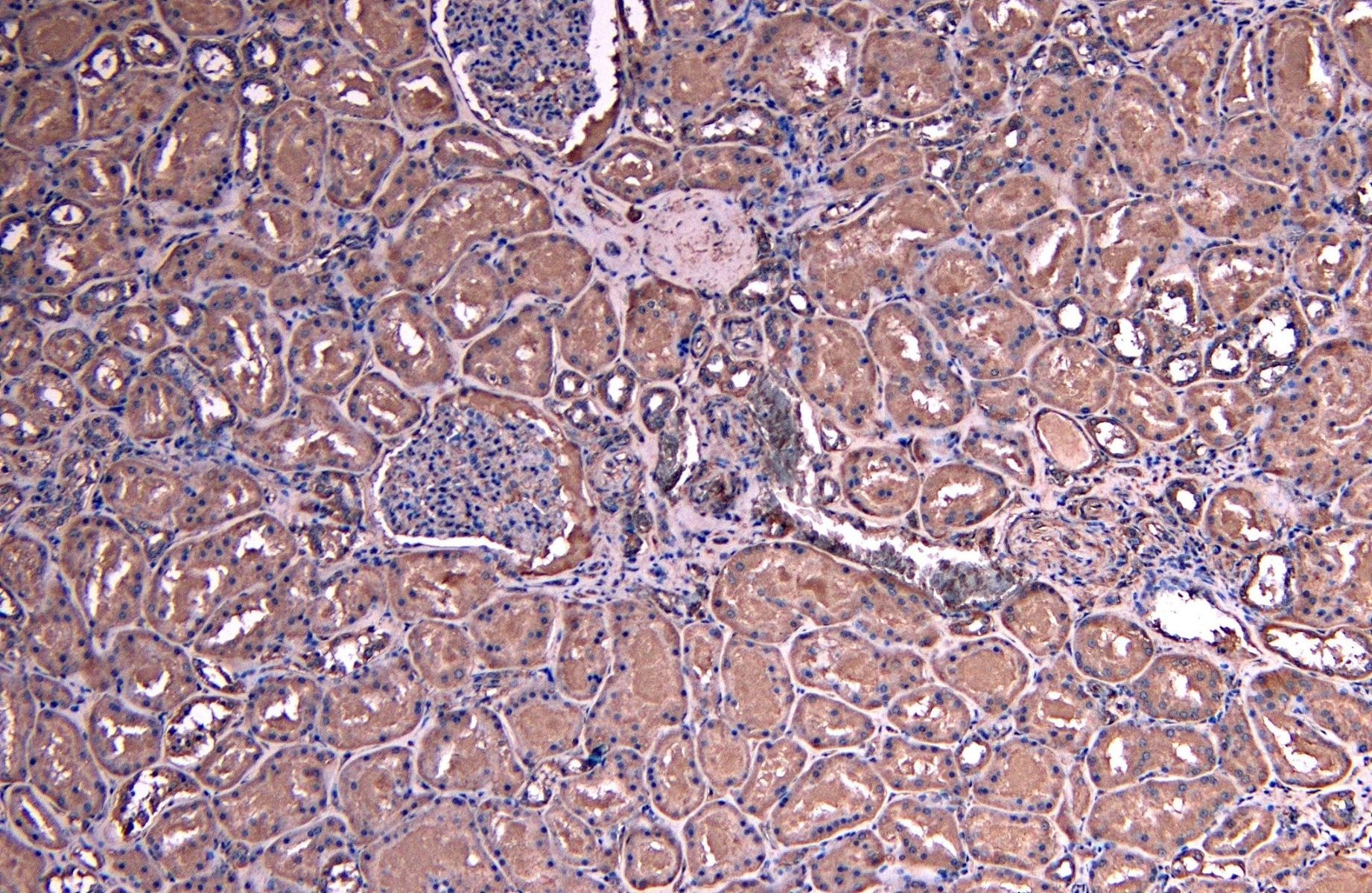 Goat anti-SOCS1 Antibody
