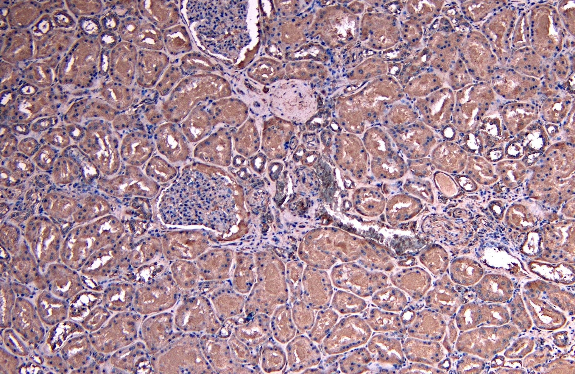 SOCS1 antibody