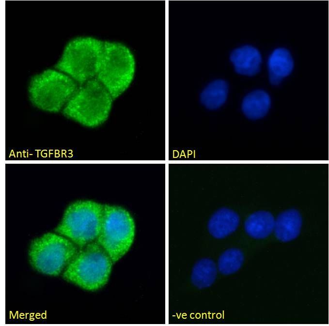 TGFBR3 antibody