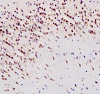 8-OHdG (DNA/RNA Damage) antibody