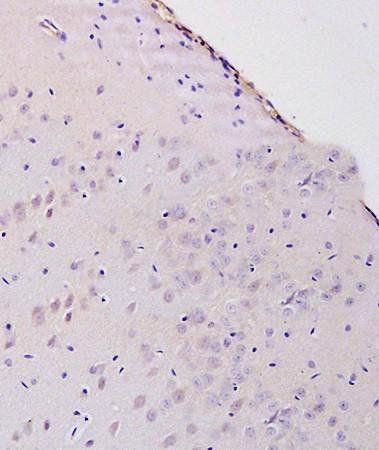 8-OHdG (DNA/RNA Damage) Rabbit Polyclonal Antibody