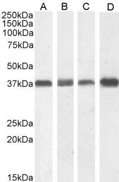 Goat anti-Nucleophosmin / NPM1 Antibody
