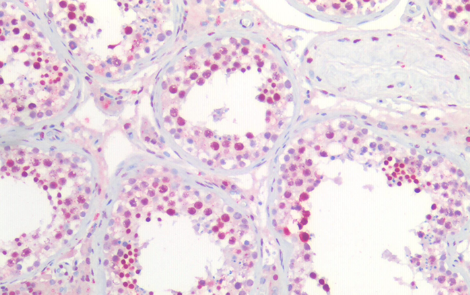 Goat anti-Nucleophosmin / NPM1 Antibody
