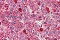Goat anti-Hamartin / TSC1 (isoform 1) Antibody