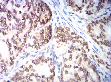 MSH2 Antibody