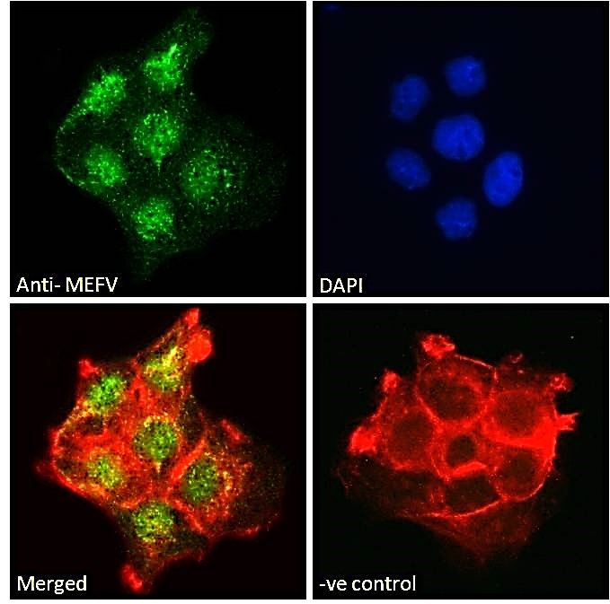 Goat anti-MEFV Antibody