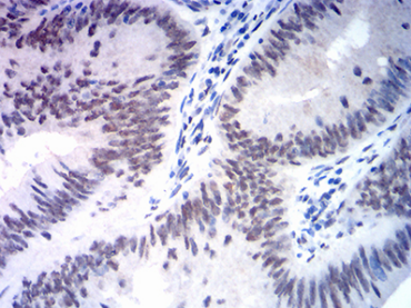 MSH2 Antibody