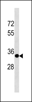 SPRY3 Antibody (C-term)