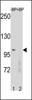CTNNB1 Antibody (N-term)