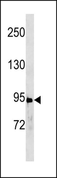 Stat3 Antibody (C-term Tyr705)