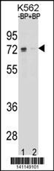 ESR1 isoform1 Antibody(C-term)