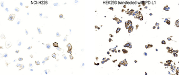 Recombinant PD-L1 antibody [AC37]
