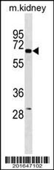 KCNJ3 Antibody (C-term)